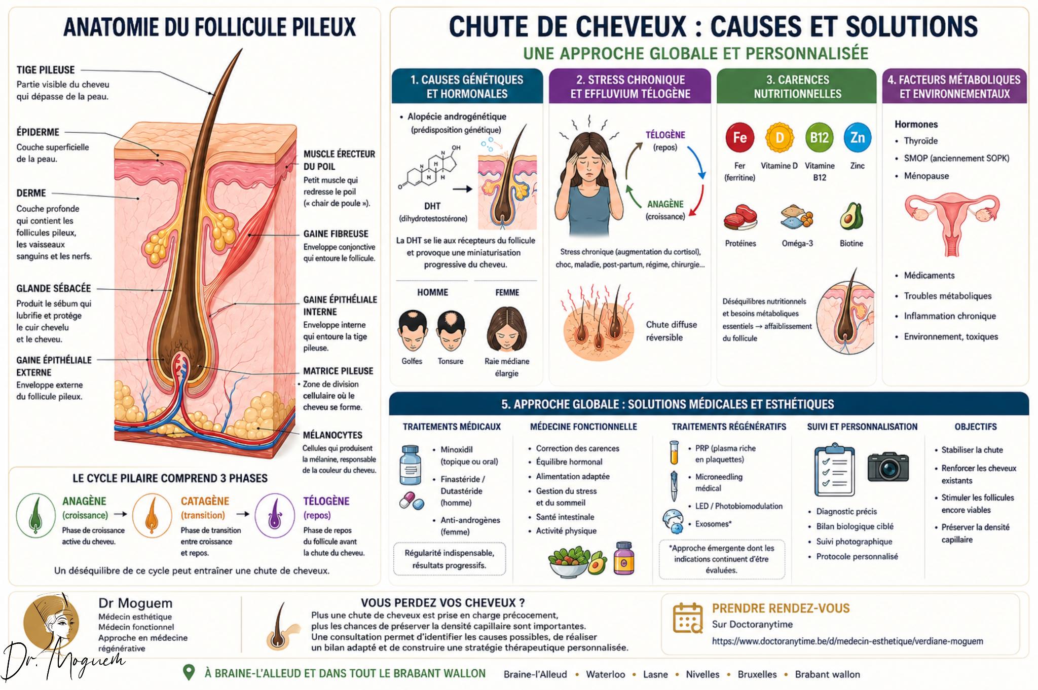 image de blog